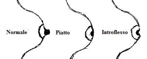 capezzoli ciechi|Cosa sapere sul capezzolo introflesso .